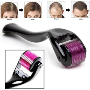 540 Micro Needle Derma Roller 1mm for skin therapy and acne scar treatment
